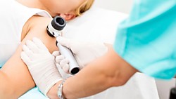 Дерматоскопия